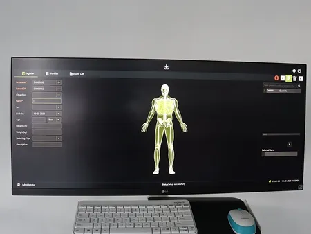 Arceau chirurgical mobile à capteur plan